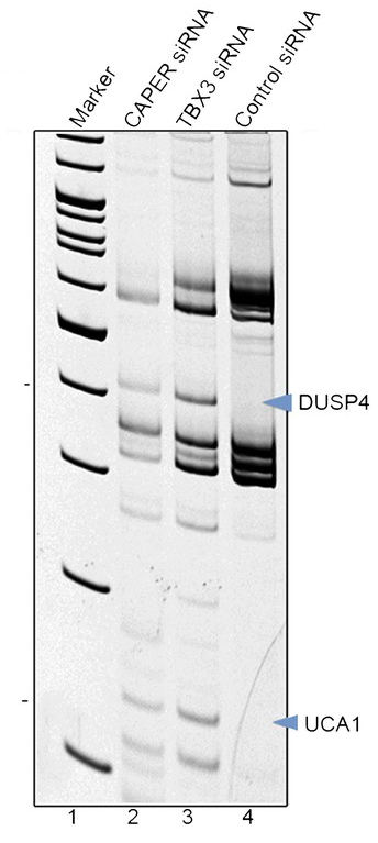 Differential display gel